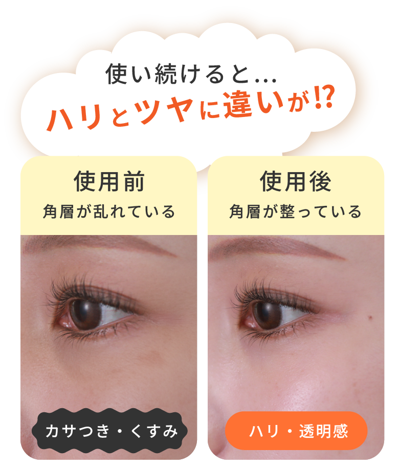 使い続けると… ハリとツヤに違いが!? 使用前:各層が乱れている(カサつき・くすみ) 使用後:各層が整っている(ハリ・透明感)
